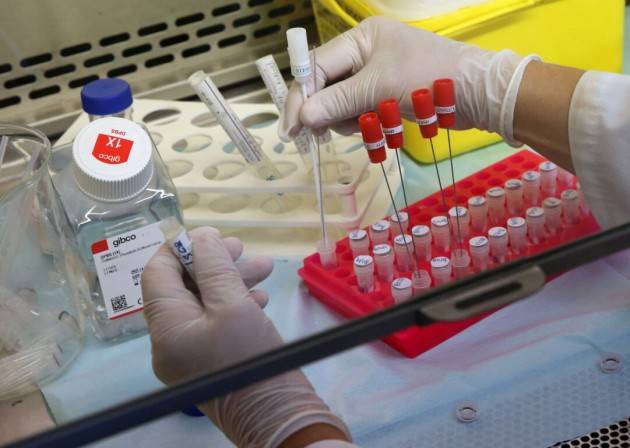 Così funzionano i test sierologici per ottenere la ''patente di immunità''